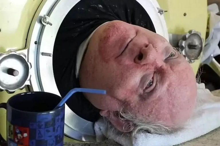 Paul Alexander: ‘Man in the iron lung’ dies after living in tank for 70 years