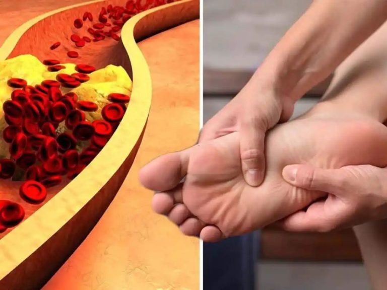 High Cholesterol Levels Symptoms In Men: Top 7 Signs of High LDL Cholesterol In Foot and Toes At Night