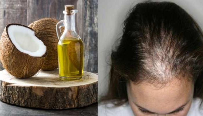 Remedy for hair fall: Mix these 2 things in coconut oil and apply it on hair and put a complete stop to hair fall!