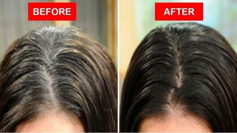 Apply this seed like this, white hair is guaranteed to turn black!