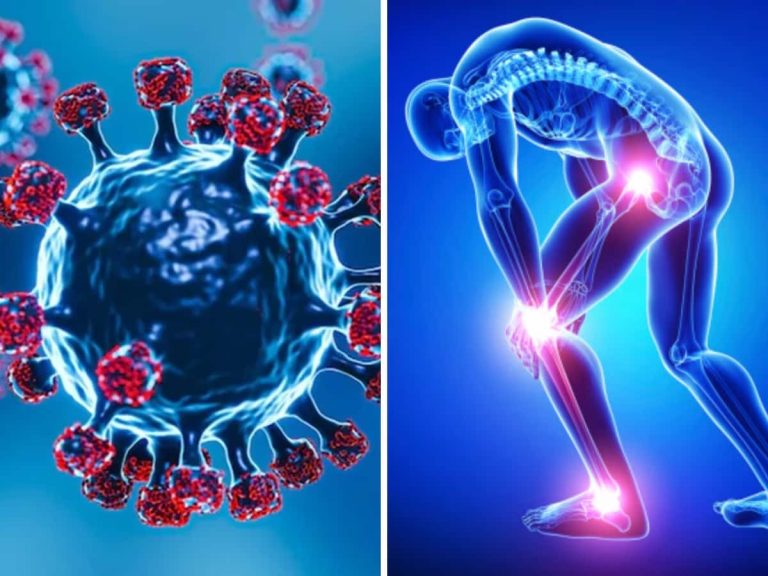 Covid-19: Risk of more than 200 diseases including arthritis in Covid patients