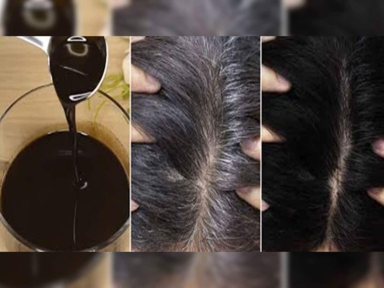 White Hair: Use oil, turmeric and neem leaves to blacken white hair, you will get excellent results without any side effects