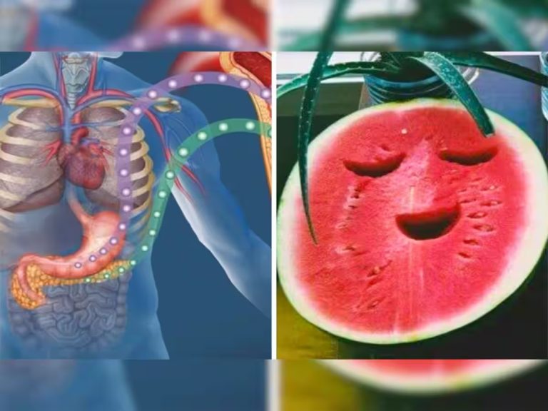 Watermelon In Diabetes: Disadvantages of eating watermelon in diabetes?  Know about the effect on blood sugar