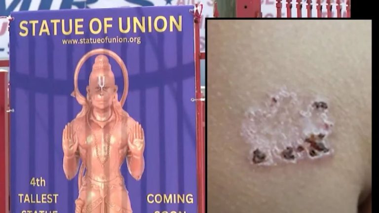 America: Indian origin person filed a case against Hindu temple, sought compensation worth crores