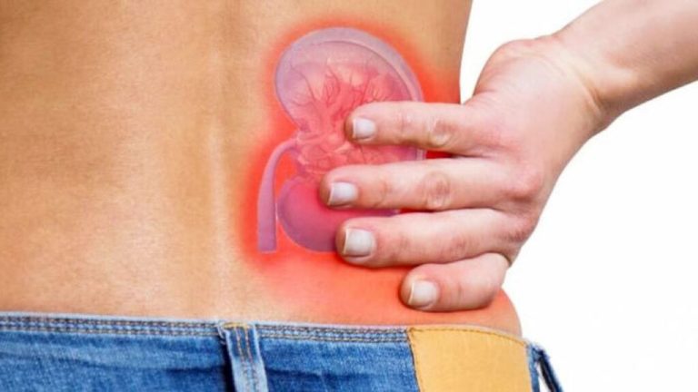 Kidney problems may increase in summer, how to be careful?