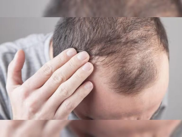 If your hair is falling, chew these seeds in the morning, in 1 week hair will start growing even in the bald part  | Live Updates, Unveiling the Latest India News Trends – ..