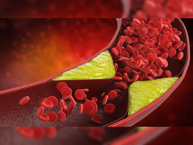 Before the bad cholesterol deposited in your veins becomes fatal, start eating these 2 things  | Live Updates, Unveiling the Latest India News Trends – ..