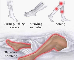 Scientists find treatment for restless leg syndrome