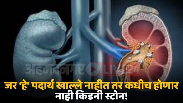 If you don't eat these foods, you will never get kidney stones, read the list of medical experts