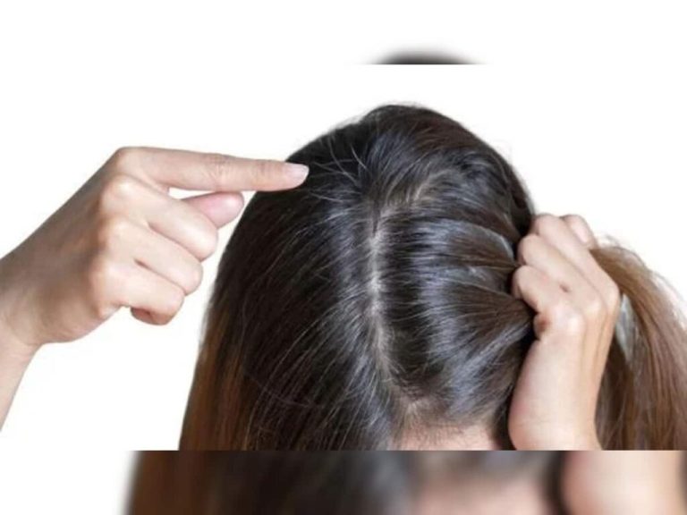 This is why hair starts turning grey in adolescence, know the home remedies to prevent grey hair  | Live Updates, Unveiling the Latest India News Trends – ..