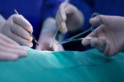 Now women's uterus removal surgery will be monitored, Supreme Court issued this order…