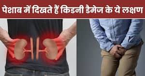 These 5 symptoms are seen in urine before your kidney gets damaged, people ignore them thinking they are normal…