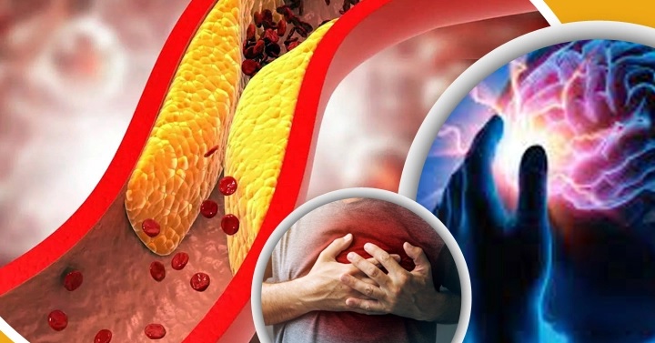 Never increase bad cholesterol in the blood by eating eleven foods