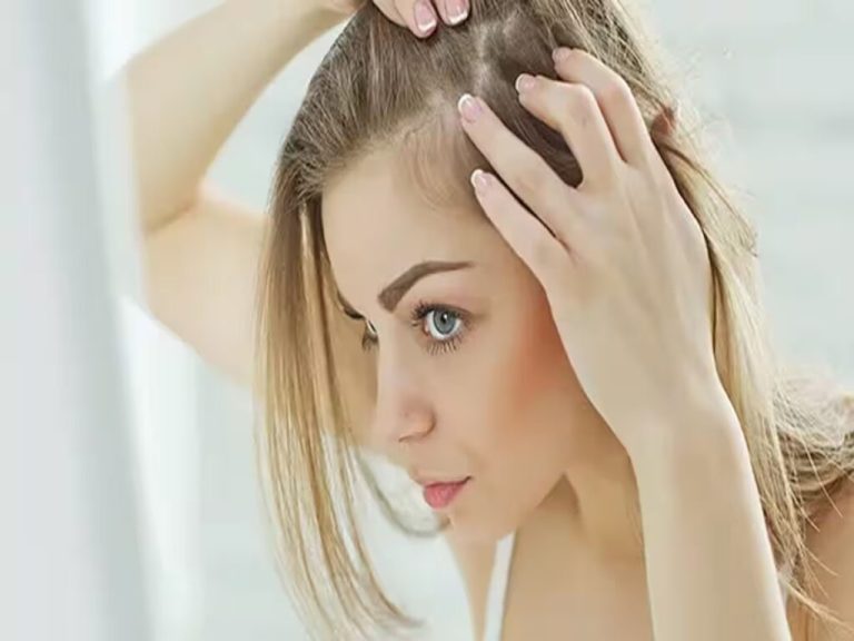 Hair fall: If you want to stop hair fall then stop eating these 5 things, the effect will be seen in 7 days  | News India – ..